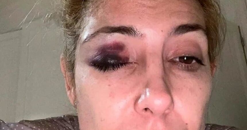 con-una-pericia-psiquiatrica-a-fabiola-yanez-en-la-justicia-portena,-alberto-fernandez-busca-frenar-la-causa-por-violencia-de-genero