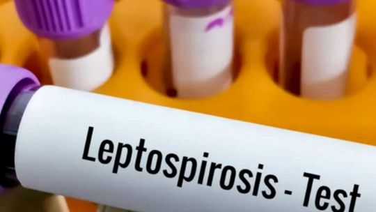 cordoba:-un-hombre-murio-por-leptospirosis-en-bell-ville
