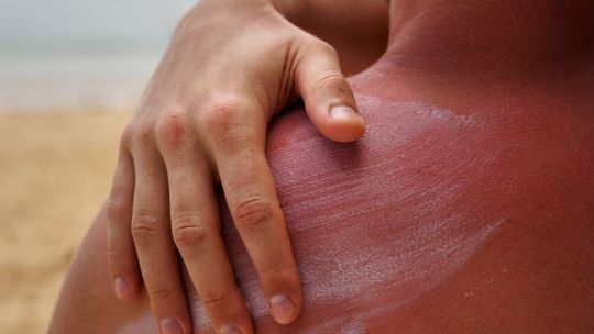 el-indice-de-radiacion-uv-para-este-sabado-sera-moderado:-conoce-los-riesgos-y-como-proteger-tu-salud