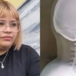 “los-policias-no-me-dijeron-que-fuera-al-medico”:-el-relato-de-la-joven-herida-por-balinazos-en-plaza-espana