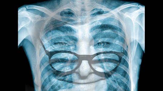 la-pobreza:-su-medicion,-sus-causas-y-como-reducirla