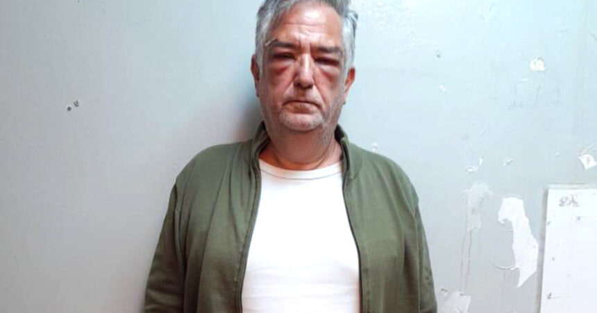 corrupcion-en-andis:-desde-la-carcel,-miguel-angel-calvete-tambien-se-nego-a-declarar