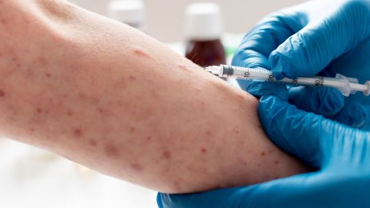 un-informe-de-instituciones-de-salud-de-michigan-advirtio-sobre-la-evolucion-clinica-del-sifilis-y-la-mutacion-de-sintomas-tradicionales