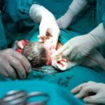 en-argentina-4-de-cada-10-bebes-nacen-por-cesarea,-el-triple-de-lo-recomendado