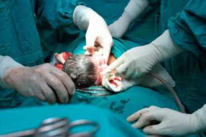 en-argentina-4-de-cada-10-bebes-nacen-por-cesarea,-el-triple-de-lo-recomendado
