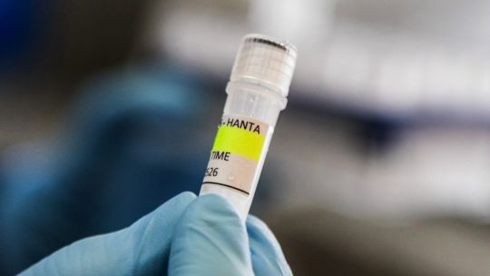 health-body-investigating-hantavirus-hit-by-fresh-milei-budget-cuts