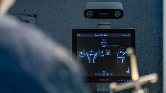 nuevo-navegador-de-rodilla-en-hospital-privado:-innovacion-y-mayor-precision
