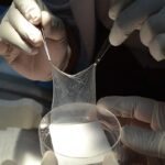 el-parque-de-la-salud-usa-tejidos-humanos-para-salvar-grandes-quemados-y-acorta-a-la-mitad-el-tiempo-de-internacion