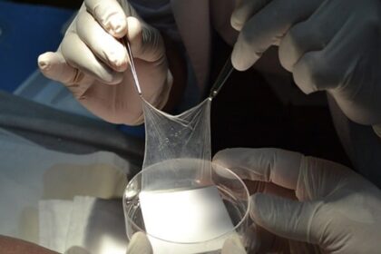el-parque-de-la-salud-usa-tejidos-humanos-para-salvar-grandes-quemados-y-acorta-a-la-mitad-el-tiempo-de-internacion