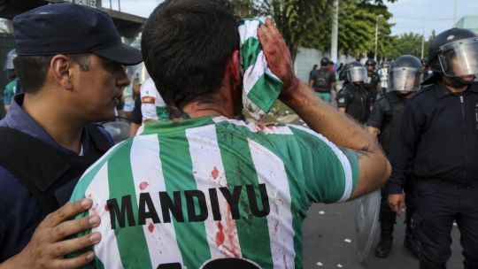 fallo-historico:-ratifican-indemnizacion-para-un-hincha-de-mandiyu-que-perdio-un-ojo-por-un-balazo-policial