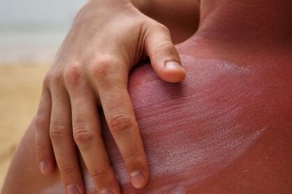 el-indice-de-rayos-uv-se-mantendra-bajo-y-sin-peligro-para-la-salud-en-gran-parte-del-pais