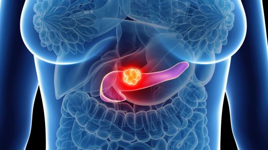 cancer-de-pancreas:-una-pildora-duplica-la-supervivencia-de-pacientes-graves