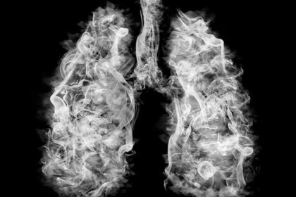 los-vapeadores-en-argentina-ya-son-legales-y-hay-alerta:-danos-para-la-salud-y-el-riesgo-en-adolescentes
