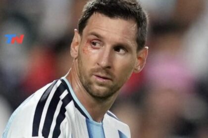 que-le-paso-a-lionel-messi-en-el-ojo-derecho-durante-el-partido-contra-suiza