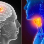 el-efecto-multiplicador:-por-que-combinar-tabaco-y-alcohol-eleva-hasta-30-veces-el-riesgo-de-cancer-de-cabeza-y-cuello
