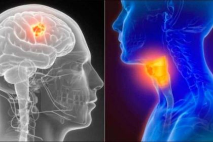 el-efecto-multiplicador:-por-que-combinar-tabaco-y-alcohol-eleva-hasta-30-veces-el-riesgo-de-cancer-de-cabeza-y-cuello