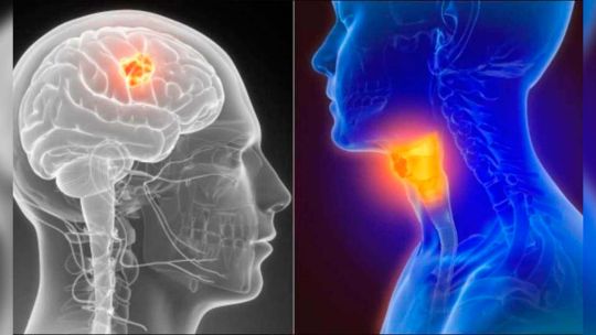 el-efecto-multiplicador:-por-que-combinar-tabaco-y-alcohol-eleva-hasta-30-veces-el-riesgo-de-cancer-de-cabeza-y-cuello
