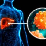 dia-mundial-de-la-hepatitis:-que-es-la-“vtv”-hepatica-y-que-estudios-incluye