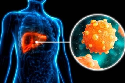 dia-mundial-de-la-hepatitis:-que-es-la-“vtv”-hepatica-y-que-estudios-incluye
