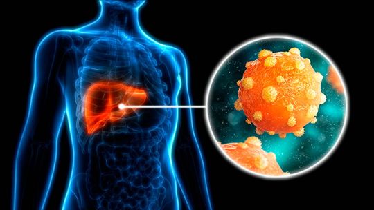 dia-mundial-de-la-hepatitis:-que-es-la-“vtv”-hepatica-y-que-estudios-incluye