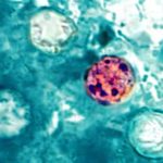 confirmaron-las-primeras-muertes-en-estados-unidos-por-un-brote-masivo-de-ciclosporiasis