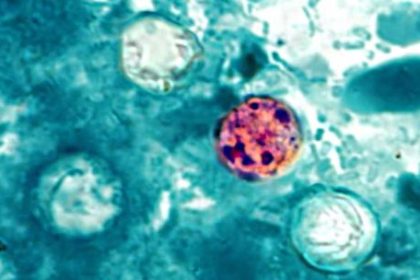 confirmaron-las-primeras-muertes-en-estados-unidos-por-un-brote-masivo-de-ciclosporiasis