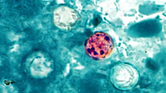 confirmaron-las-primeras-muertes-en-estados-unidos-por-un-brote-masivo-de-ciclosporiasis