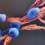 reprogramar-la-genetica-del-sistema-inmune:-la-apuesta-que-cambiara-el-tratamiento-del-cancer