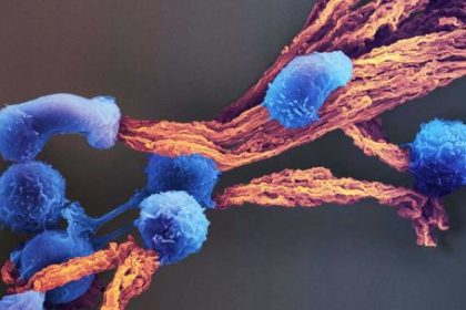 reprogramar-la-genetica-del-sistema-inmune:-la-apuesta-que-cambiara-el-tratamiento-del-cancer