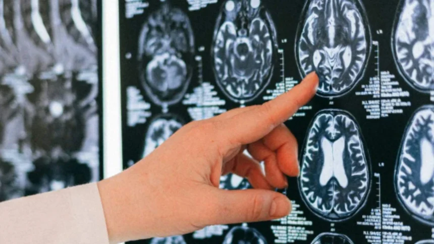 advierten-que-no-controlar-los-niveles-de-una-vitamina-esencial-para-el-cuerpo-podria-alterar-la-memoria