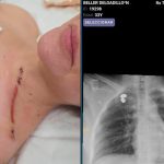 caso-cerimedo:-tras-la-carta-del-exasesor-de-milei,-revelan-chats-que-lo-complican-y-su-expareja-mostro-las-heridas-del-ataque-desde-el-hospital