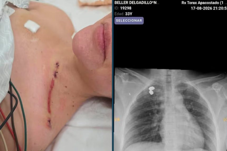 caso-cerimedo:-tras-la-carta-del-exasesor-de-milei,-revelan-chats-que-lo-complican-y-su-expareja-mostro-las-heridas-del-ataque-desde-el-hospital