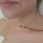 nadia-beller-compartio-nuevas-imagenes-de-las-heridas-que-sufrio-tras-el-ataque-de-sicarios:-“que-dios-te-perdone-fernando-cerimedo”