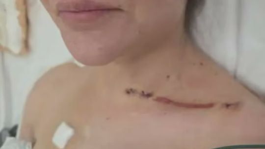 nadia-beller-compartio-nuevas-imagenes-de-las-heridas-que-sufrio-tras-el-ataque-de-sicarios:-“que-dios-te-perdone-fernando-cerimedo”