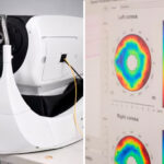 mas-del-50%-de-peruanos-con-glaucoma-no-sabe-que-lo-tiene:-nueva-tecnologia-busca-evitar-la-ceguera