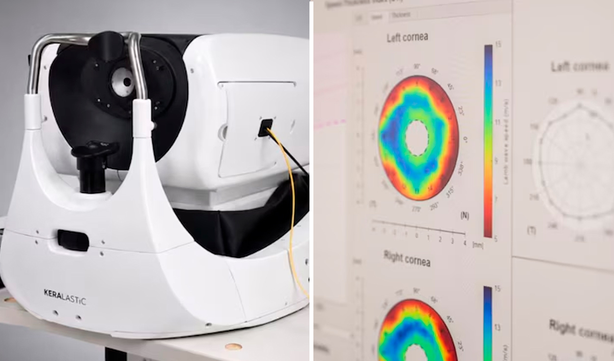mas-del-50%-de-peruanos-con-glaucoma-no-sabe-que-lo-tiene:-nueva-tecnologia-busca-evitar-la-ceguera