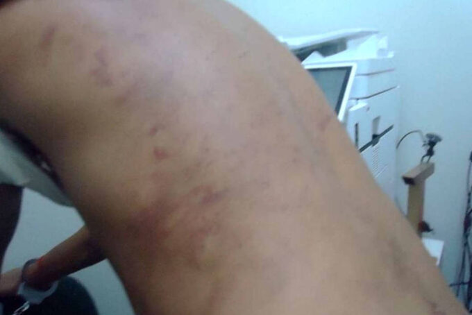 ministerio-publico-investiga-denuncias-de-tortura-por-detentos-em-presidios-do-agreste-de-pernambuco