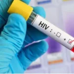 mas-de-46.000-casos-de-vih-en-bolivia-generan-alerta-en-profesionales-de-la-salud