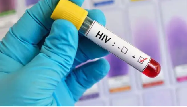 mas-de-46.000-casos-de-vih-en-bolivia-generan-alerta-en-profesionales-de-la-salud