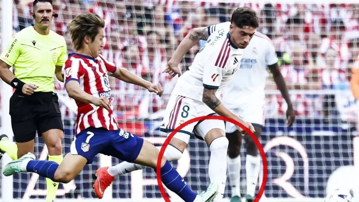 que-es-un-esguince-de-grado-3-en-un-tobillo-como-el-que-dejo-fuera-a-federico-valverde-de-la-seleccion-uruguaya-y-cuanto-tiempo-de-recuperacion-lleva