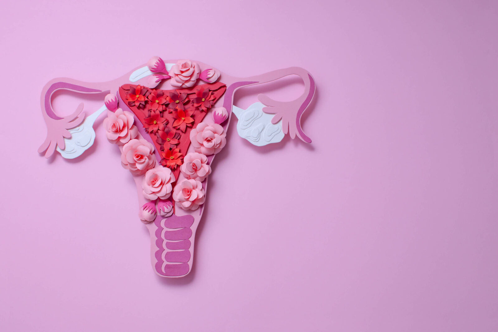 ciclo-menstrual-irregular-pode-indicar-somp;-saiba-como-a-condicao-afeta-o-corpo