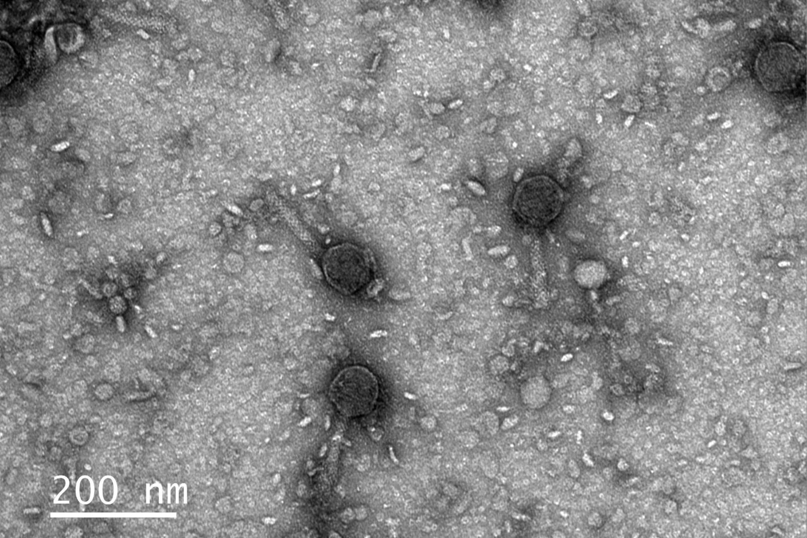 em-virus,-cientistas-descobrem-o-que-pode-vir-a-ser-uma-nova-ferramenta-de-edicao-genetica