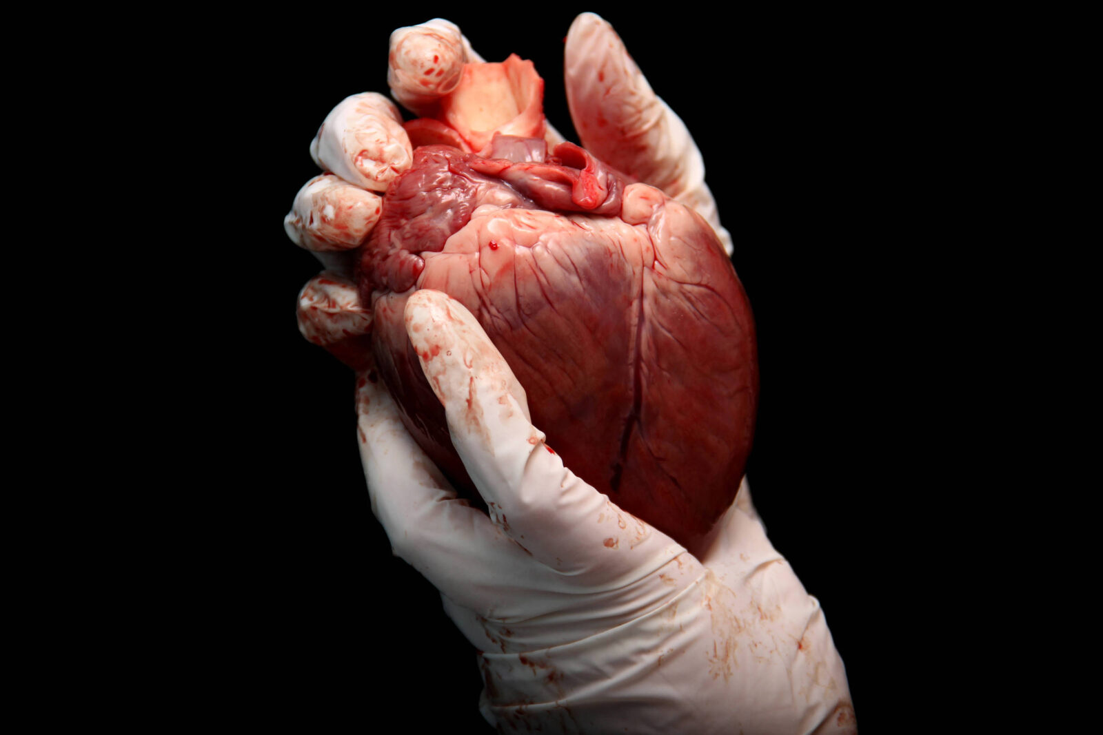 coracao-de-doador-mais-velho-parece-rejuvenescer-ao-ser-transplantado-em-paciente-mais-jovem