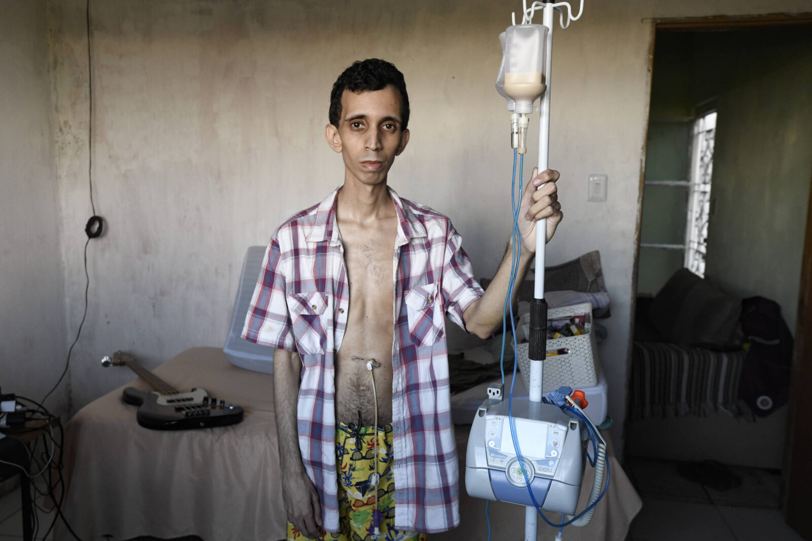 sem-diagnostico,-pacientes-com-doencas-raras-passam-anos-em-busca-de-respostas