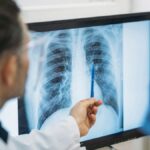 que-es-un-adenocarcinoma-pulmonar,-el-tipo-de-tumor-maligno-que-le-extirparon-al-papa-leon-xiv