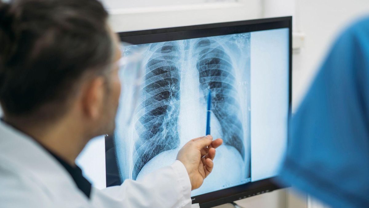 que-es-un-adenocarcinoma-pulmonar,-el-tipo-de-tumor-maligno-que-le-extirparon-al-papa-leon-xiv