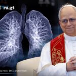 ¿que-es-el-adenocarcinoma-pulmonar?-el-tipo-de-cancer-detectado-al-papa-leon-xiv-tras-cirugia