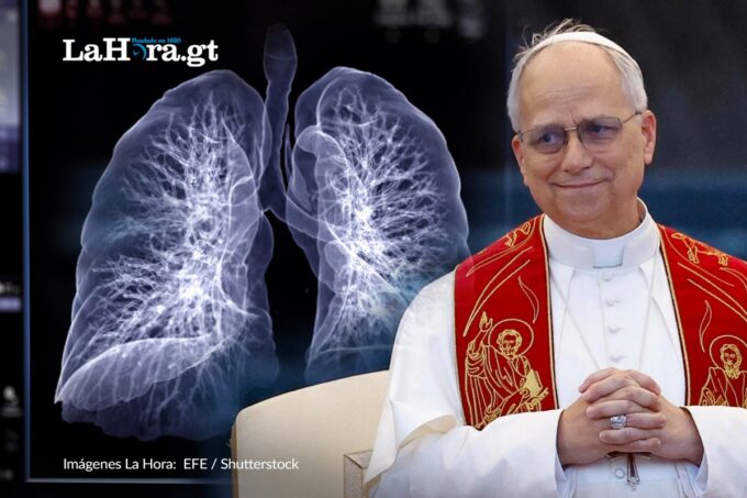 ¿que-es-el-adenocarcinoma-pulmonar?-el-tipo-de-cancer-detectado-al-papa-leon-xiv-tras-cirugia