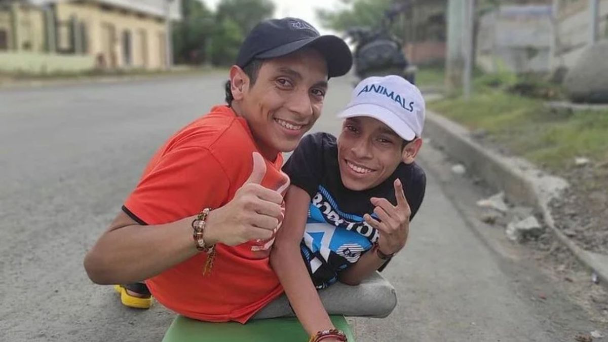 video-|-revelan-como-fueron-los-ultimos-minutos-de-los-“siameses-de-ecuador”:-el-caso-que-conmueve-a-las-redes