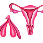 pela-primeira-vez,-cirurgia-reconstroi-clitoris-apos-cancer-de-vulva